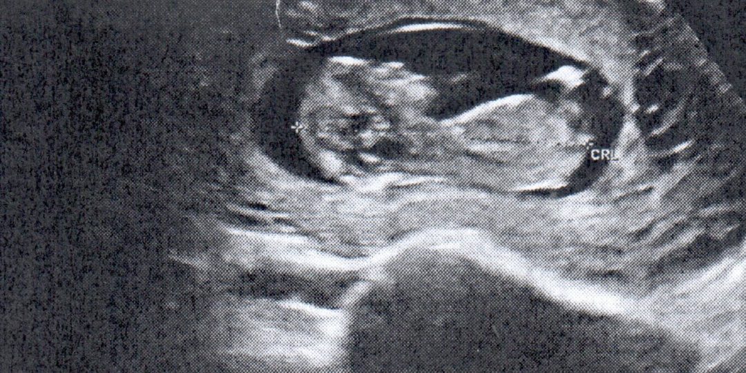 https://www.satsukibare.it/wp-content/uploads/2020/04/2020_03_30_eco_2-1080x540.jpg