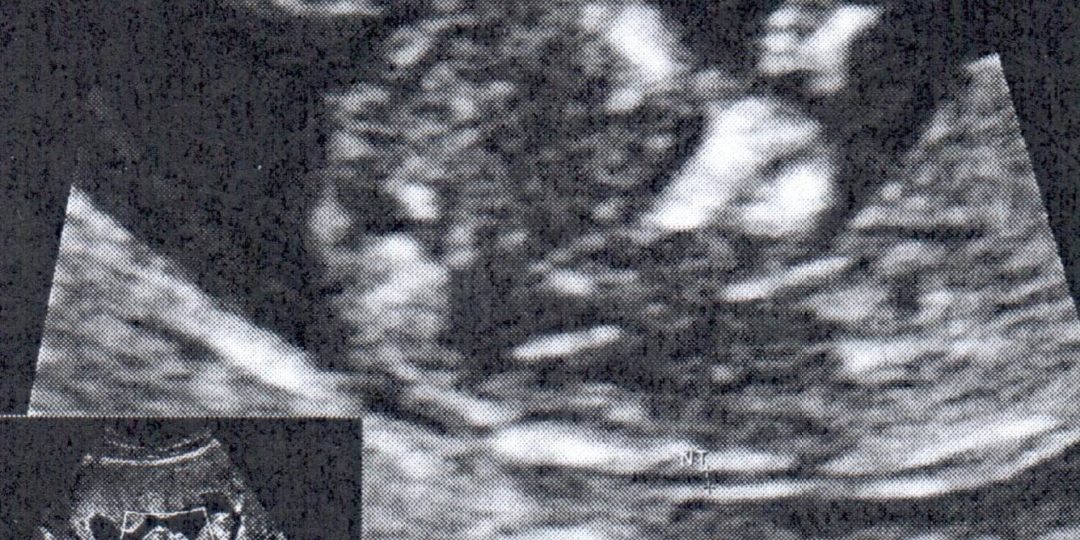 https://www.satsukibare.it/wp-content/uploads/2020/04/2020_03_30_eco_5-1080x540.jpg