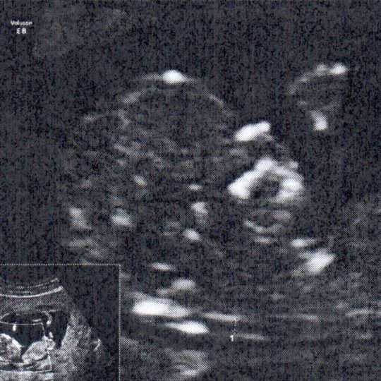 https://www.satsukibare.it/wp-content/uploads/2020/04/2020_03_30_eco_7-540x540.jpg